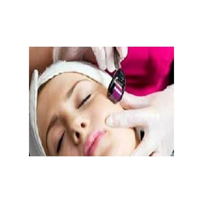 Dermaroller Titanyum 540 İğneli 1.00 mm